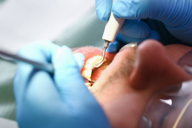 Best Broken or Chipped Tooth Repair in Lynbrook, NY