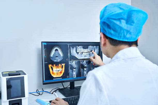 Best Emergency Wisdom Tooth Extraction in Lynbrook, NY